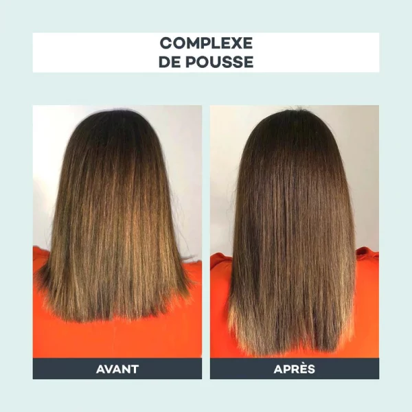 Complexe de pousse pour 3mois D-LAB nutricosmetics – Image 2